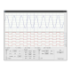 Oscilloscope et Logic Analyzer Shield pour Raspberry Pi